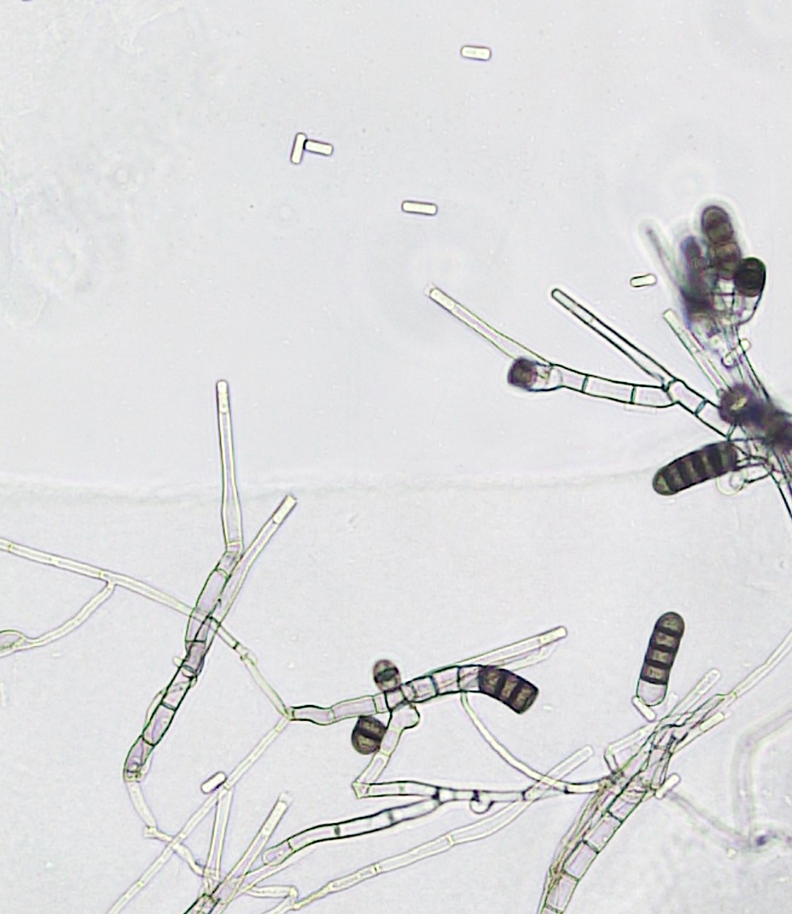 Microscopic view of B. basicola showing rectangular endospores and larger brown resting spores.